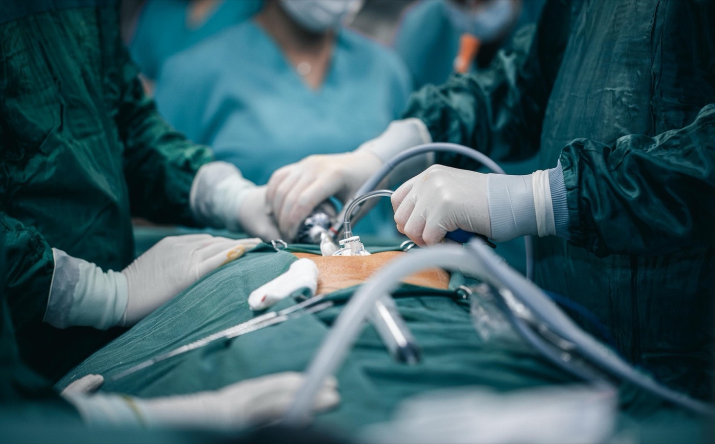 Transplantácia v operačnej sále